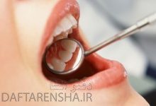 آینه دندانپزشکی چه نوع آیینه ای است علوم سوم