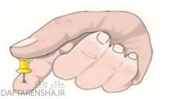 چرا گرفتن پونز بین دو انگشت و فشردن آن می تواند سبب آسیب رساندن به یکی از انگشت ها شود؟
