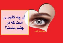 آن چیست که در پیشانی ماست